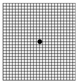1,老年性黄斑变性如何自我测试?