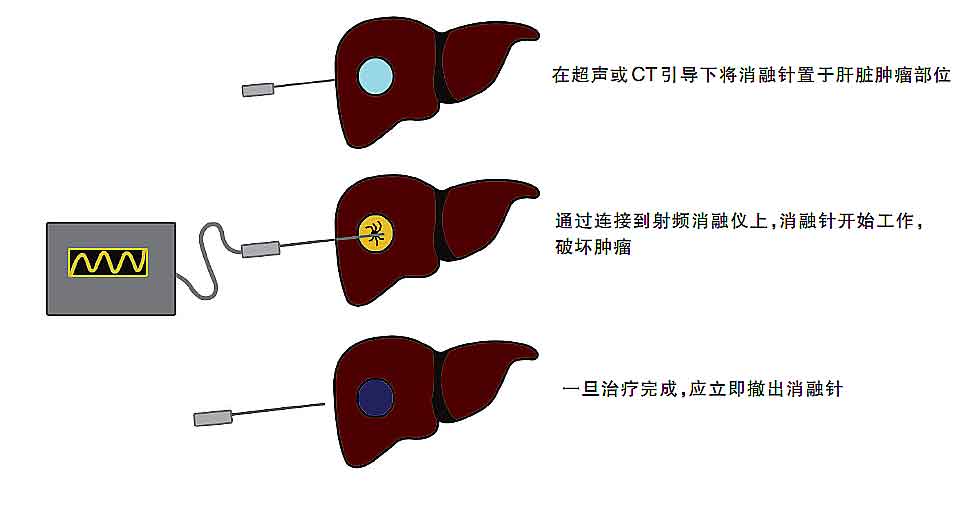 针缝是什么成语_这是什么成语看图(2)